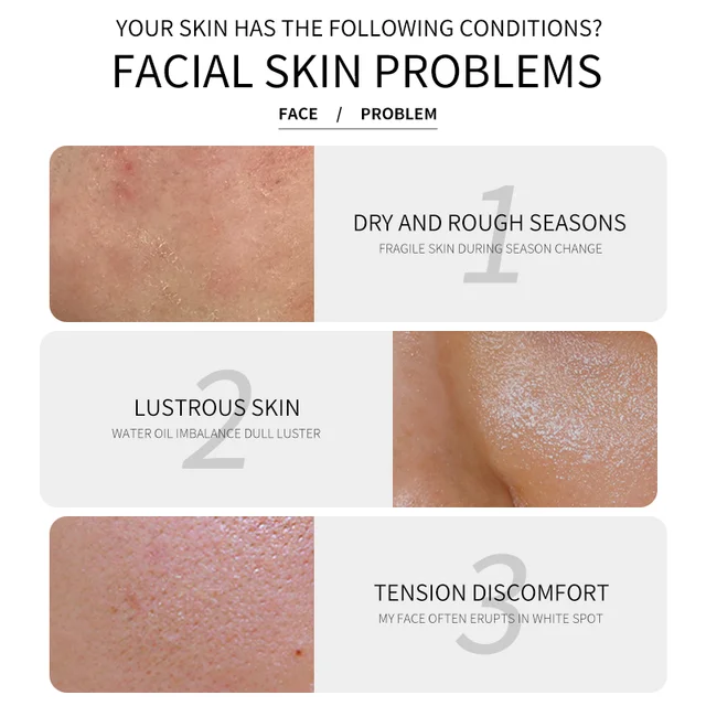 Biosphere 4 in 1 Brighten Skin Care Set, Moisturizer Acne Care of sensitive Skin